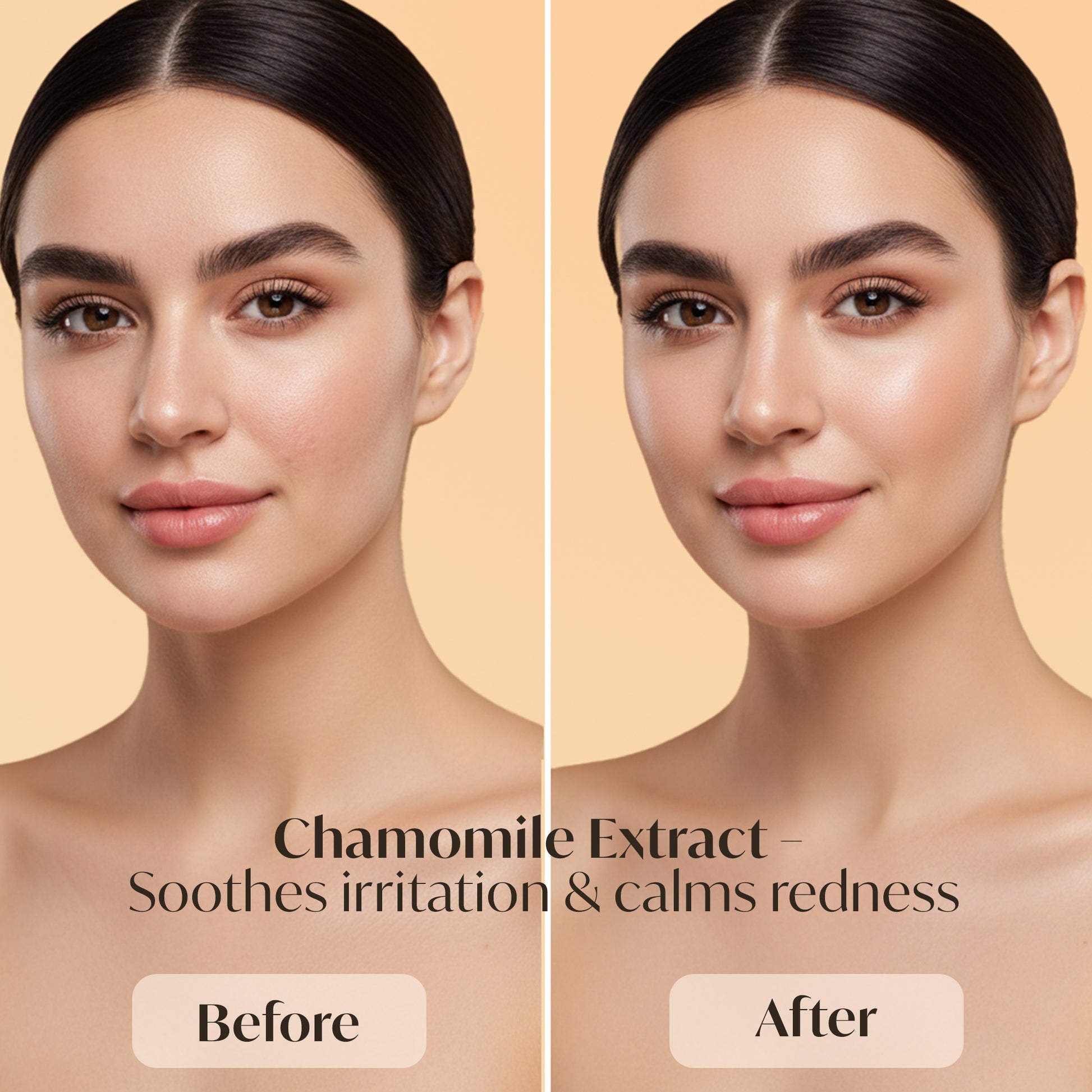 Aqua Boost Gel Moisturizer